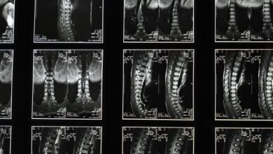cbd for sciatica relief